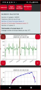 Polar H10 Arrhythmia MOD APK for Android Download
