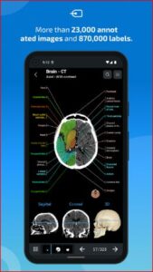 e-Anatomy APK for Android Download
